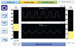 Registration in continuous mode of the pressures supplied, parameter calculation and their display